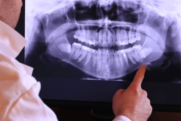 Best Tooth Pain Emergency Relief  in Lebanon, OH