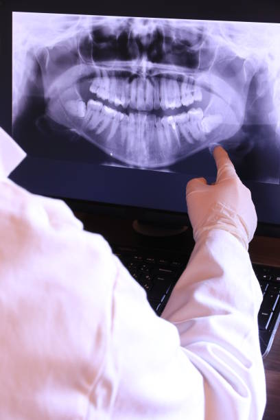 Best Dentist for Tooth Abscess  in Lebanon, OH