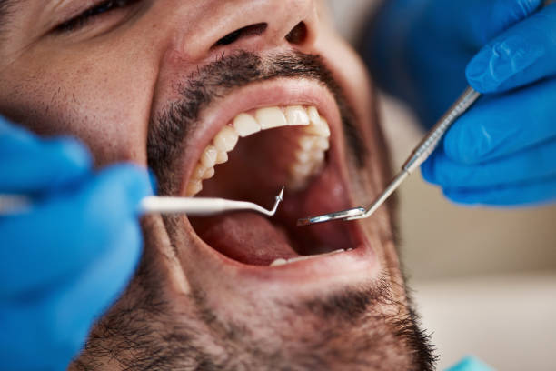 Best Emergency Gum Pain Relief  in Lebanon, OH