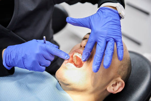 Best Cracked Tooth Emergency Dentist  in Lebanon, OH